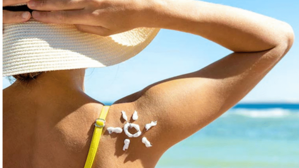 how to remove sun burn