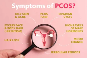 pcos